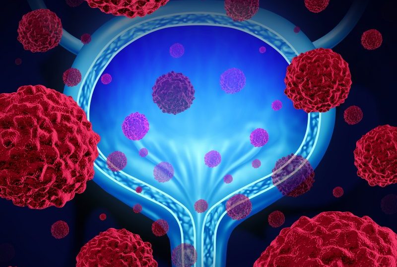 EV-103 Cohort K: Promising data for first-line combination therapy of enfortumab vedotin plus pembrolizumab for patients with urothelial carcinoma