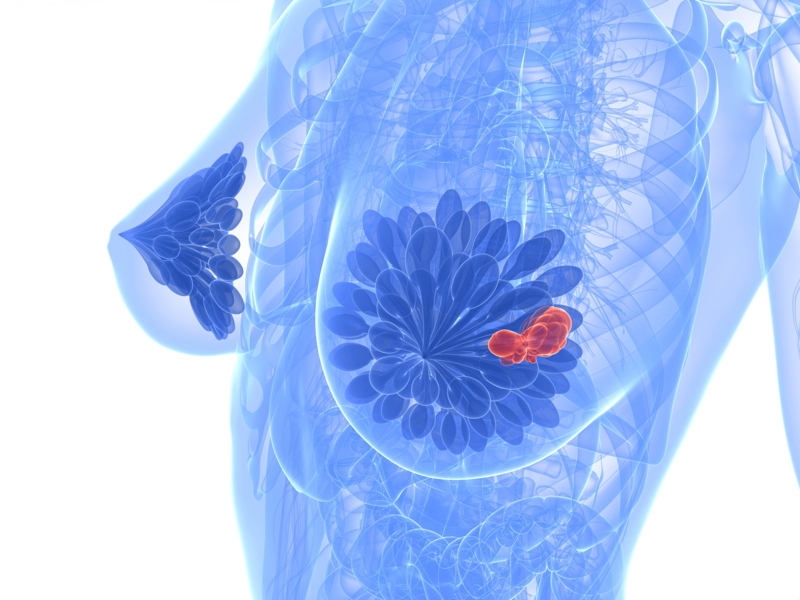 Key updates from ESMO Breast 2021