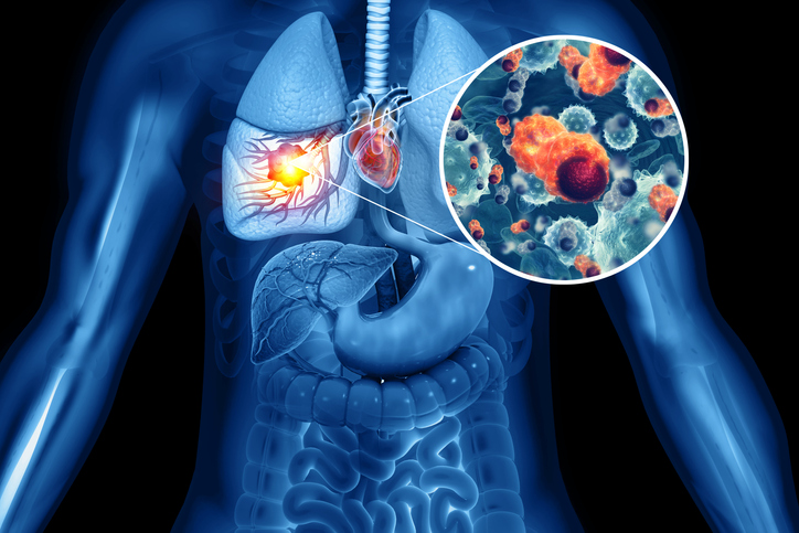 Top abstracts from WCLC 2023