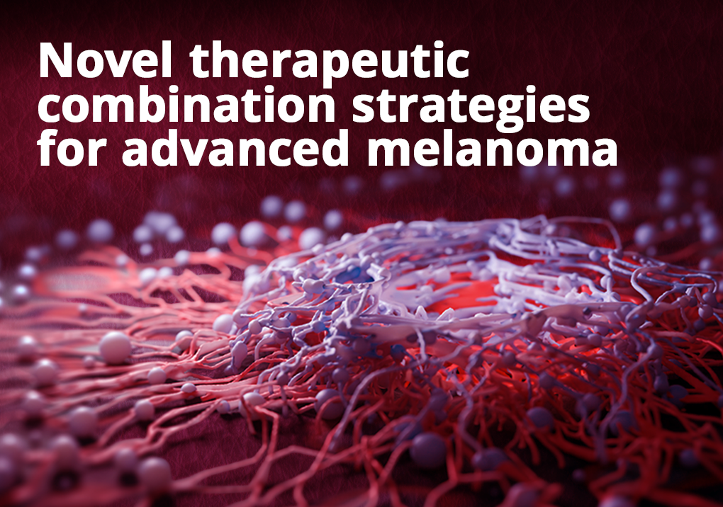 Novel therapeutic combination strategies for advanced melanoma