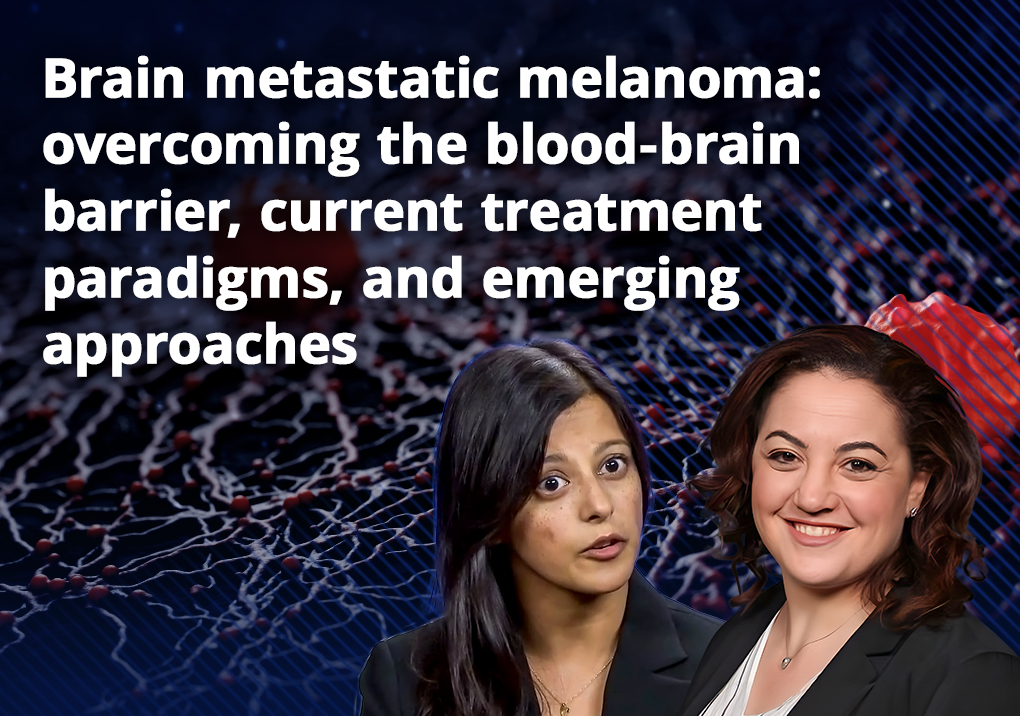 Brain metastatic melanoma: overcoming the blood-brain barrier, current treatment paradigms, and emerging approaches