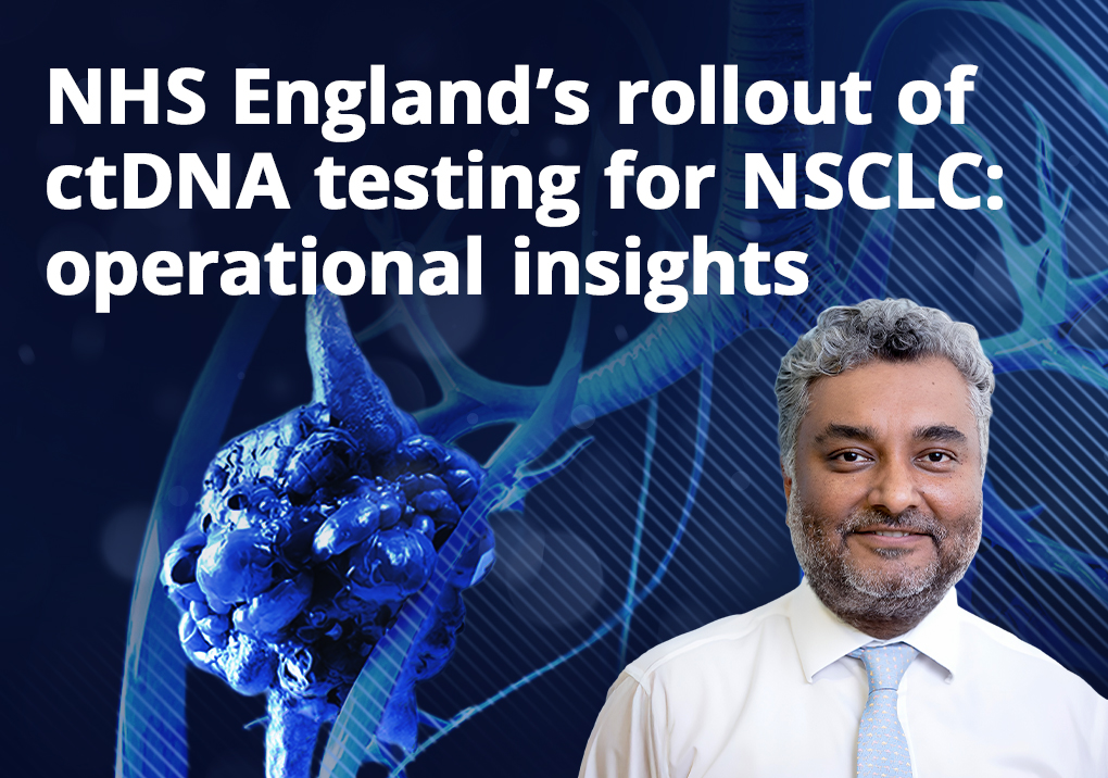 NHS England's rollout of ctDNA testing for NSCLC: operational insights